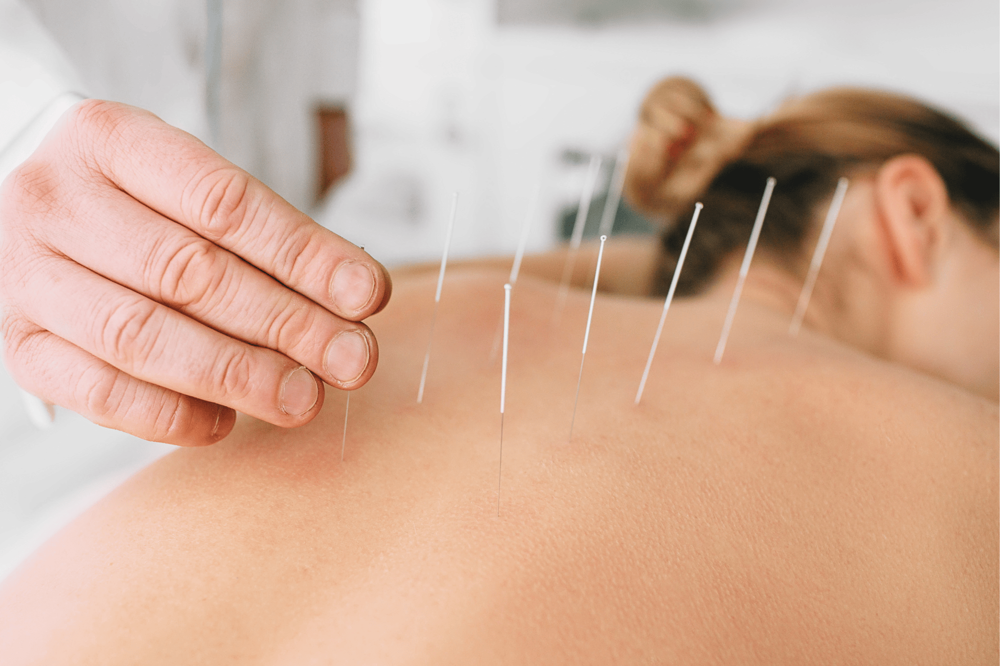 The Art of Acupuncture: Traditional Chinese Medicine – TRUE Health Family  Medicine